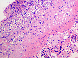 Placenta