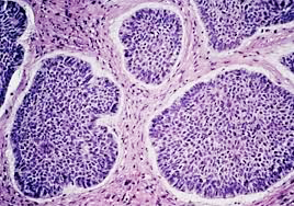 Dermatopatología