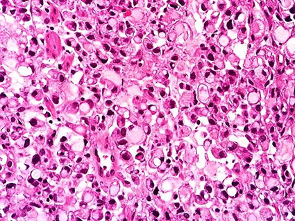 Patología Gastrointestinal